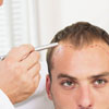 Пересадка волос может навредить внешности