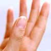 Медики сказали, какие болезни можно определить по ногтям на руках
