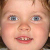 Молочные зубы без кариеса: Серебрить ли детские зубки?