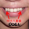 Йоба: Кривые зубы – главный тренд в Японии! ФОТО и ВИДЕО!