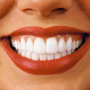 Как уберечь зубы от перидонта? – Факторы красивой улыбки