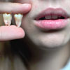 Если зубы не прорезались? – Лечим ретенцию зубов