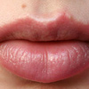 Как вылечить обветренные губы? Помада для морозов