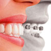 Известный стоматолог рассказал об отбеливании зубов и Джулии Робертс