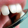 Как правильно устранить зубные отложения и зубной камень