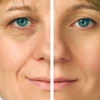 Разглаживание морщин: Домашние маски для глаз с эффектом лифтинга