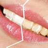 Почему зубы желтые? – 6 причин, о которых никто не задумывается
