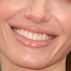 Голливудская улыбка по-российски: что говорят стоматологи?